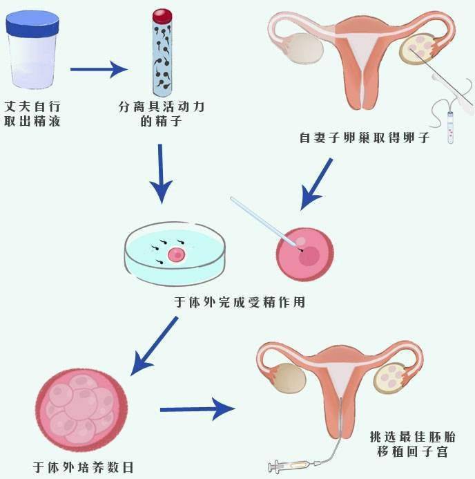 清远供卵公司