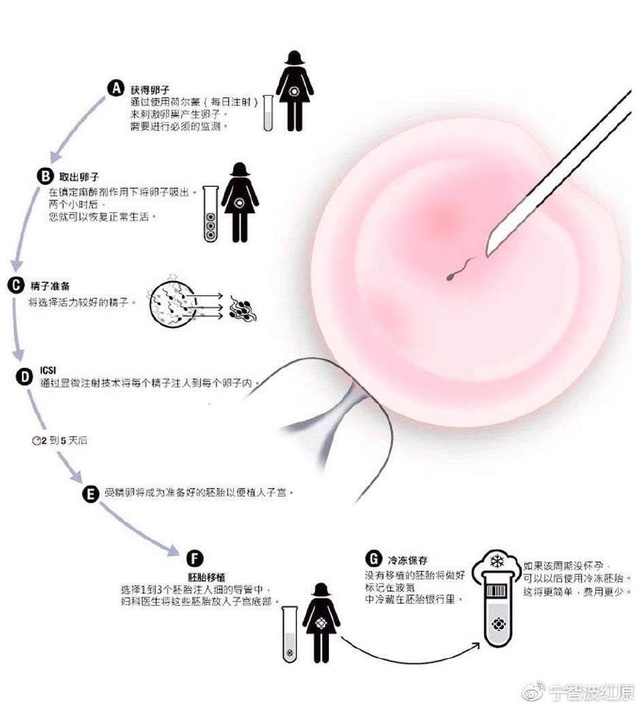 新疆供卵代生